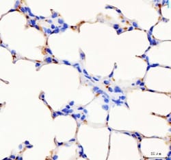 Invitrogen PF4 Polyclonal Antibody 100 &mu;g | Buy Online | Invitrogen&trade; | Fisher Scientific