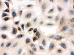 Invitrogen REA Polyclonal Antibody 100 &mu;g; Unconjugated:Antibodies,