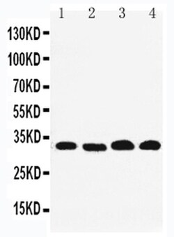 Invitrogen REA Polyclonal Antibody 100 &mu;g; Unconjugated:Antibodies,