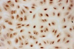 Invitrogen PIAS1 Polyclonal Antibody 100 &mu;g; Unconjugated:Antibodies,