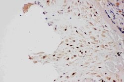 Invitrogen PIAS1 Polyclonal Antibody 100 &mu;g; Unconjugated:Antibodies,