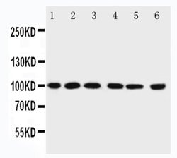 Invitrogen PIAS1 Polyclonal Antibody 100 &mu;g; Unconjugated:Antibodies,