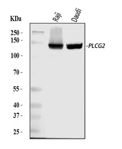 Invitrogen PLCG2 Polyclonal Antibody 100 &mu;g; Unconjugated:Anticuerpos