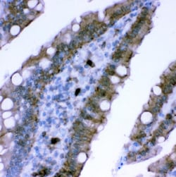 Invitrogen Plectin Polyclonal Antibody 100 &mu;g | Buy Online | Invitrogen&trade; | Fisher Scientific