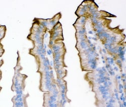 Invitrogen Plectin Polyclonal Antibody 100 &mu;g | Buy Online | Invitrogen&trade; | Fisher Scientific
