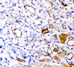 Invitrogen Plectin Polyclonal Antibody 100 &mu;g | Buy Online | Invitrogen&trade; | Fisher Scientific
