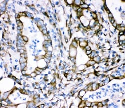 Invitrogen Plectin Polyclonal Antibody 100 &mu;g | Buy Online | Invitrogen&trade; | Fisher Scientific