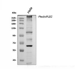 Invitrogen Plectin Polyclonal Antibody 100 &mu;g | Buy Online | Invitrogen&trade; | Fisher Scientific