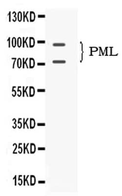 Invitrogen PML Polyclonal Antibody 100 &mu;g | Buy Online | Invitrogen&trade; | Fisher Scientific
