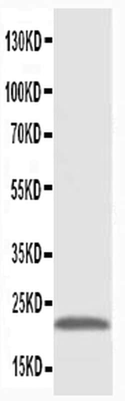 Invitrogen PMVK Polyclonal Antibody 100 &mu;g | Buy Online | Invitrogen&trade; | Fisher Scientific
