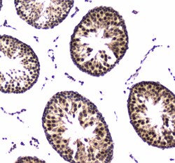 Invitrogen POLR2A Polyclonal Antibody 100 &mu;g; Unconjugated:Antibodies,