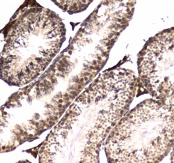 Invitrogen POLR2A Polyclonal Antibody 100 &mu;g; Unconjugated:Antibodies,