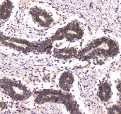 Invitrogen POLR2A Polyclonal Antibody 100 &mu;g; Unconjugated:Antibodies,
