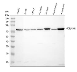 Invitrogen Cytochrome P450 Reductase Polyclonal Antibody 100 &mu;g | Buy Online | Invitrogen&trade; | Fisher Scientific