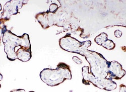 Invitrogen Cytochrome P450 Reductase Polyclonal Antibody 100 &mu;g | Buy Online | Invitrogen&trade; | Fisher Scientific