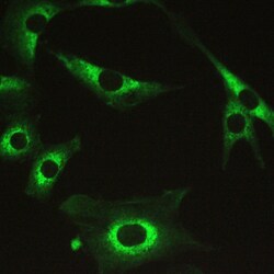 Invitrogen MYPT1 Polyclonal Antibody 100 &mu;g | Buy Online | Invitrogen&trade; | Fisher Scientific