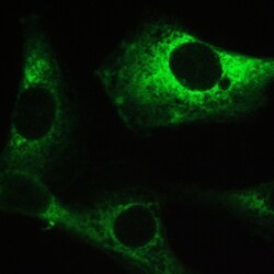 Invitrogen MYPT1 Polyclonal Antibody 100 &mu;g | Buy Online | Invitrogen&trade; | Fisher Scientific