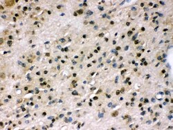 Invitrogen MYPT1 Polyclonal Antibody 100 &mu;g | Buy Online | Invitrogen&trade; | Fisher Scientific