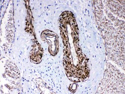 Invitrogen CPI-17 Polyclonal Antibody 100 &mu;g; Unconjugated:Antibodies,
