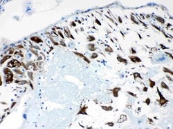 Invitrogen CPI-17 Polyclonal Antibody 100 &mu;g; Unconjugated:Antibodies,