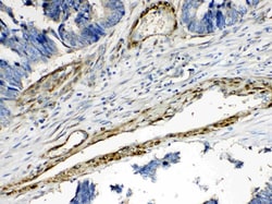 Invitrogen CPI-17 Polyclonal Antibody 100 &mu;g; Unconjugated:Antibodies,
