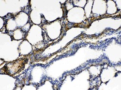 Invitrogen CPI-17 Polyclonal Antibody 100 &mu;g; Unconjugated:Antibodies,