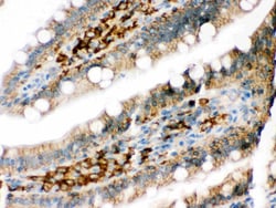 Invitrogen DARPP-32 Polyclonal Antibody 100 &mu;g; Unconjugated:Antibodies,