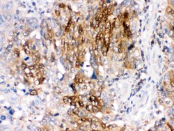 Invitrogen DARPP-32 Polyclonal Antibody 100 &mu;g; Unconjugated:Antibodies,