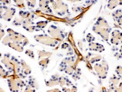 Invitrogen DARPP-32 Polyclonal Antibody 100 &mu;g; Unconjugated:Antibodies,