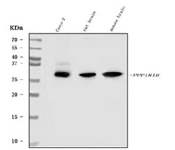 Invitrogen DARPP-32 Polyclonal Antibody 100 &mu;g; Unconjugated:Antibodies,
