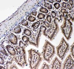 Invitrogen Blimp-1 Polyclonal Antibody 100 &mu;g | Buy Online | Invitrogen&trade; | Fisher Scientific