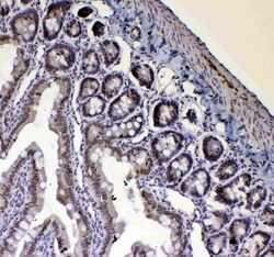 Invitrogen Blimp-1 Polyclonal Antibody 100 &mu;g | Buy Online | Invitrogen&trade; | Fisher Scientific