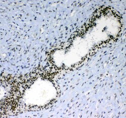 Invitrogen Blimp-1 Polyclonal Antibody 100 &mu;g | Buy Online | Invitrogen&trade; | Fisher Scientific