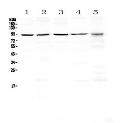 Invitrogen Blimp-1 Polyclonal Antibody 100 &mu;g | Buy Online | Invitrogen&trade; | Fisher Scientific