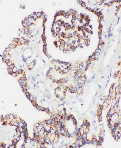 Invitrogen PRDX5 Polyclonal Antibody 100 &mu;g; Unconjugated:Antibodies,