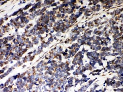 Invitrogen PRDX5 Polyclonal Antibody 100 &mu;g; Unconjugated:Antibodies,