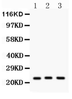 Invitrogen PRDX5 Polyclonal Antibody 100 &mu;g; Unconjugated:Antibodies,