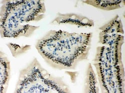 Invitrogen PKC epsilon Polyclonal Antibody 100 &mu;g; Unconjugated:Antibodies,