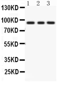 Invitrogen PKC epsilon Polyclonal Antibody 100 &mu;g; Unconjugated:Antibodies,
