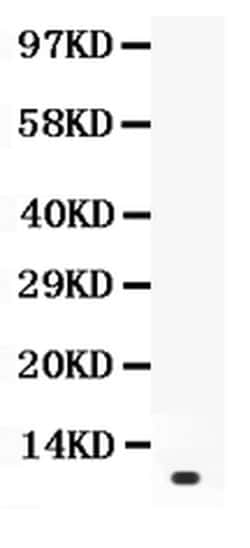 Invitrogen Prolactin Polyclonal Antibody 100 &mu;g; Unconjugated:Antibodies,