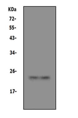 Invitrogen PrP Polyclonal Antibody 100 &mu;g; Unconjugated:Antibodies,