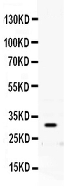 Invitrogen PrP Polyclonal Antibody 100 &mu;g; Unconjugated:Anticuerpos