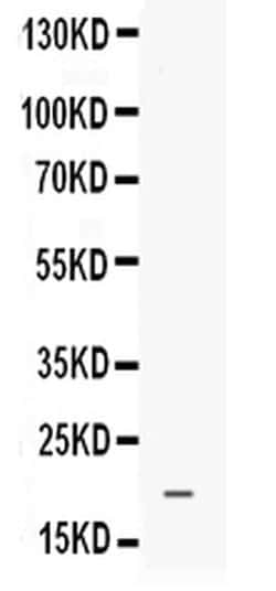 Invitrogen PROK1 Polyclonal Antibody 100 &mu;g | Buy Online | Invitrogen&trade; | Fisher Scientific