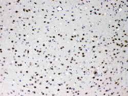 Invitrogen PSMA3 Polyclonal Antibody 100 &mu;g; Unconjugated:Antibodies,