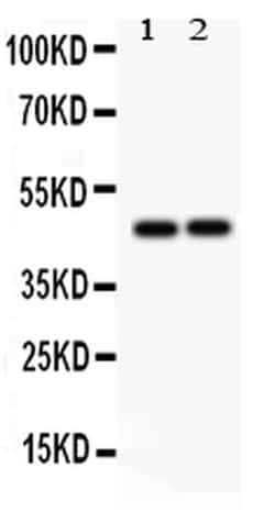 Invitrogen PTPN2 Polyclonal Antibody 100 &mu;g; Unconjugated:Antibodies,