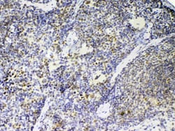 Invitrogen PTPN22 Polyclonal Antibody 100 &mu;g; Unconjugated:Antibodies,