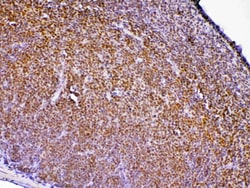 Invitrogen PTPN22 Polyclonal Antibody 100 &mu;g; Unconjugated:Antibodies,