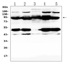 Invitrogen PTPN22 Polyclonal Antibody 100 &mu;g; Unconjugated:Antibodies,