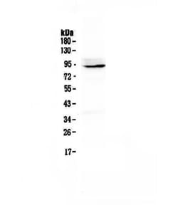 Invitrogen PTPN22 Polyclonal Antibody 100 &mu;g; Unconjugated:Antibodies,