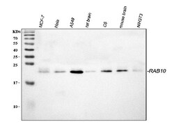 Invitrogen RAB10 Polyclonal Antibody 100 &mu;g; Unconjugated:Antibodies,